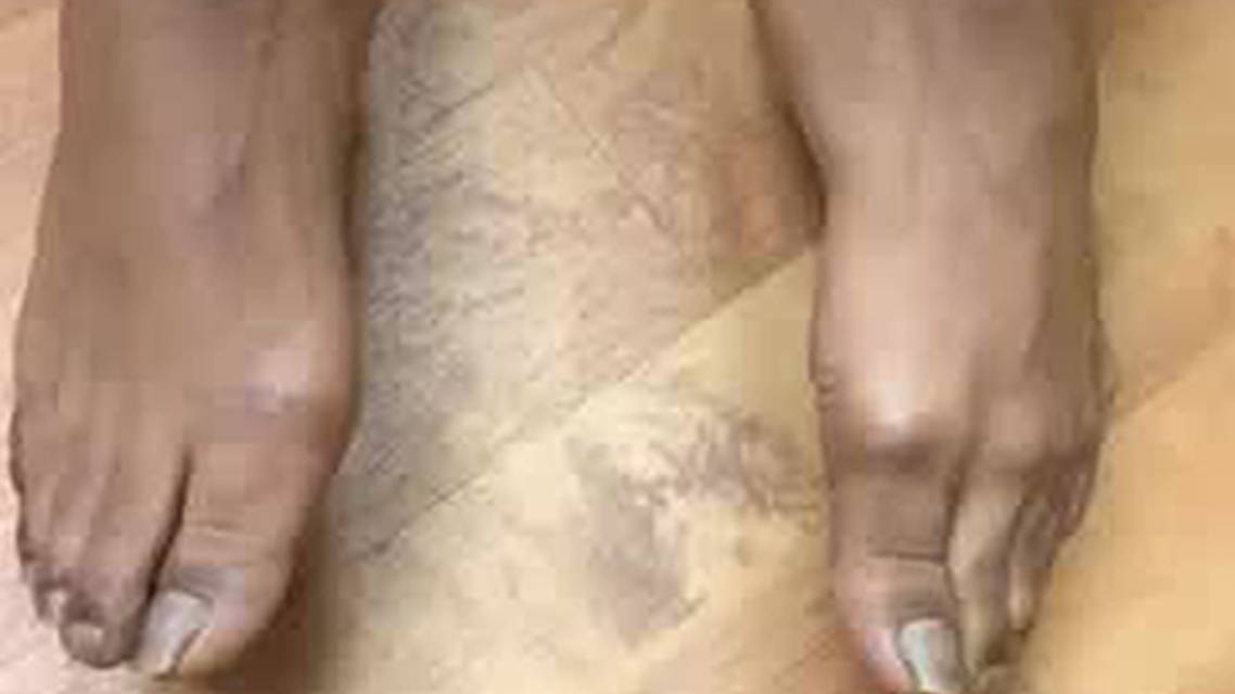 Continuous Movement of the Toes thumbnail