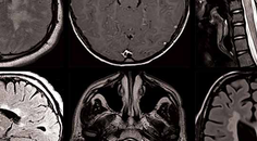 A Neurologist Goes to Business School