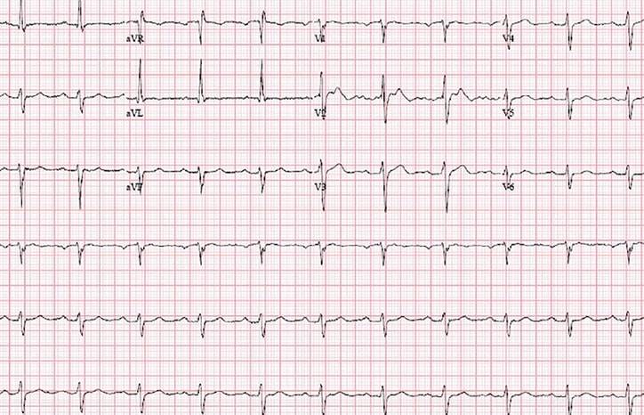 Challenge Case Report Left Sided Headache and Dizziness