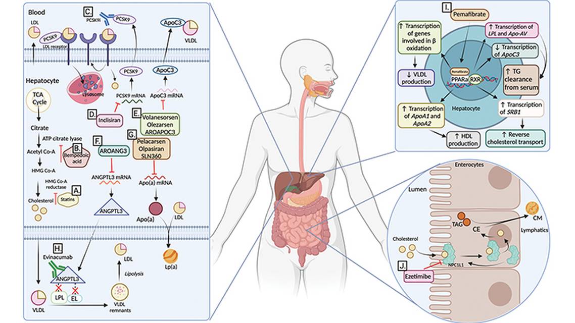 Novel Lipid Lowering Agents and Stroke PreventionNew Tools New Targets
