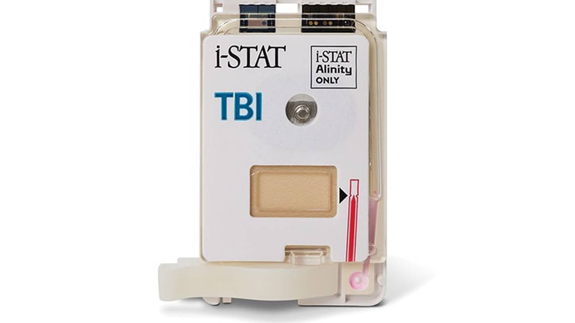 Real World Experience Using Biomarker Testing for the Evaluation of Acute Traumatic Brain Injury