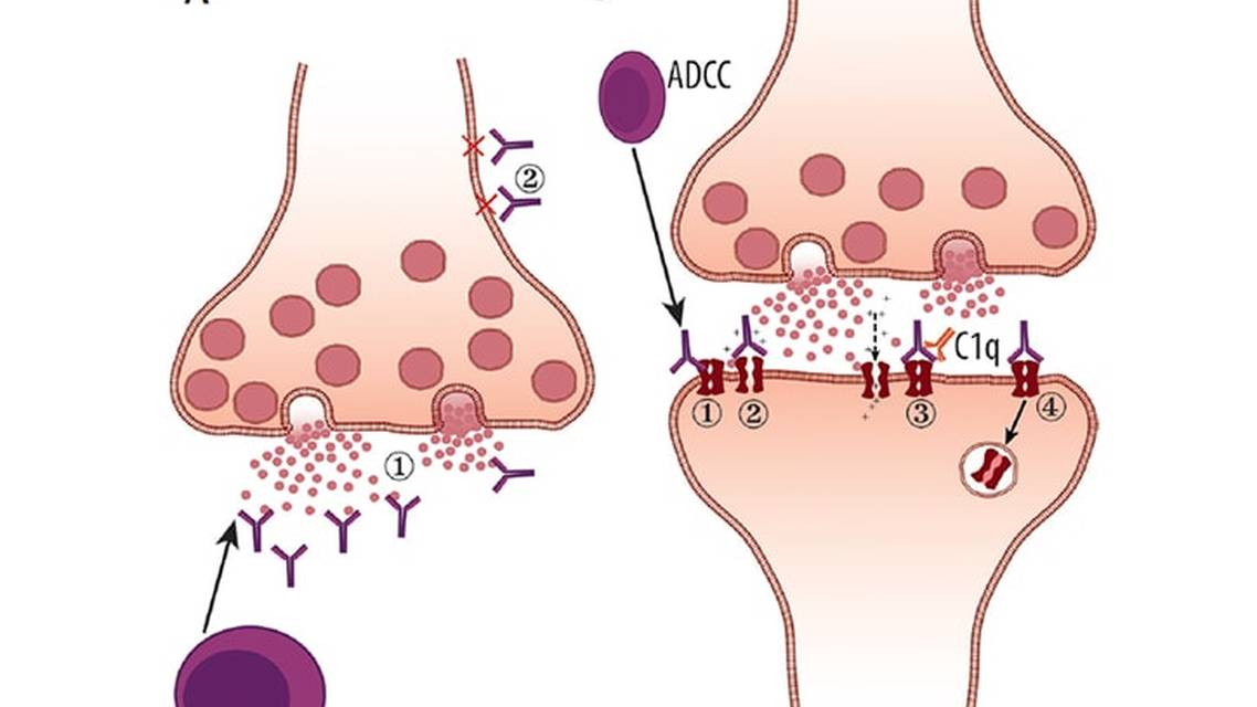Autoimmune Movement Disorders in Children