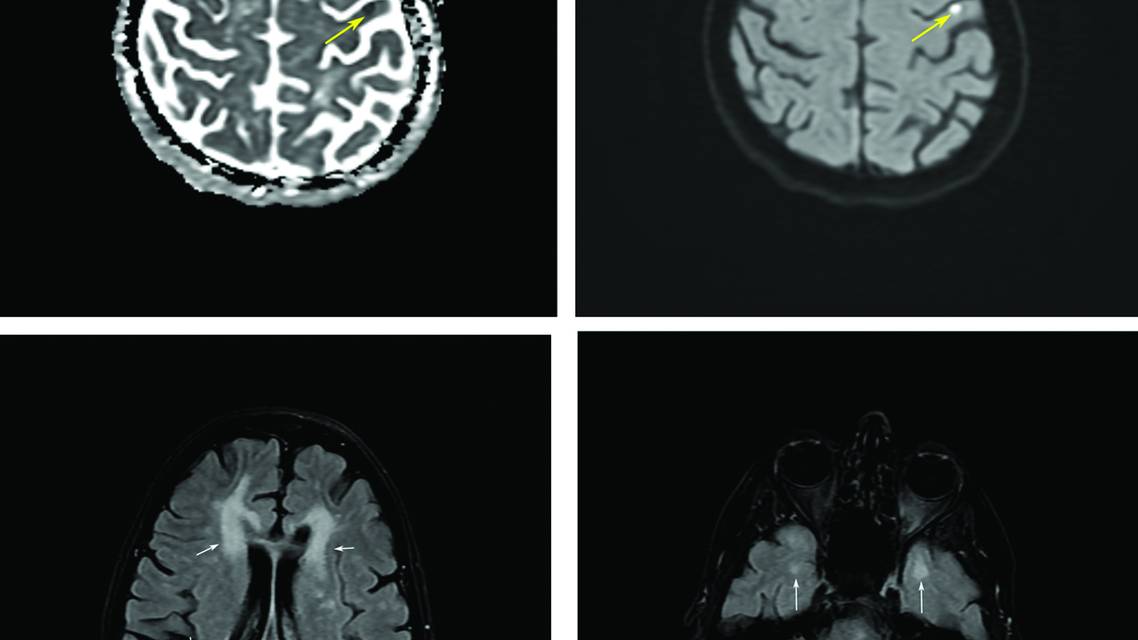 PN0825 CR Fig3