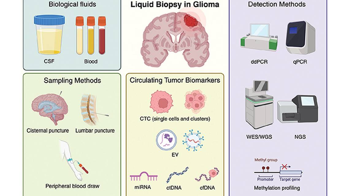 Circulating Biomarkers in Diffuse Gliomas Current Landscape and Future Directions