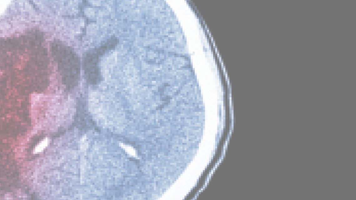FDA Filing for Cannabidiol Data on Diet and Exercise and Brain Aging and Memory Boston Scientific Indication for DBS