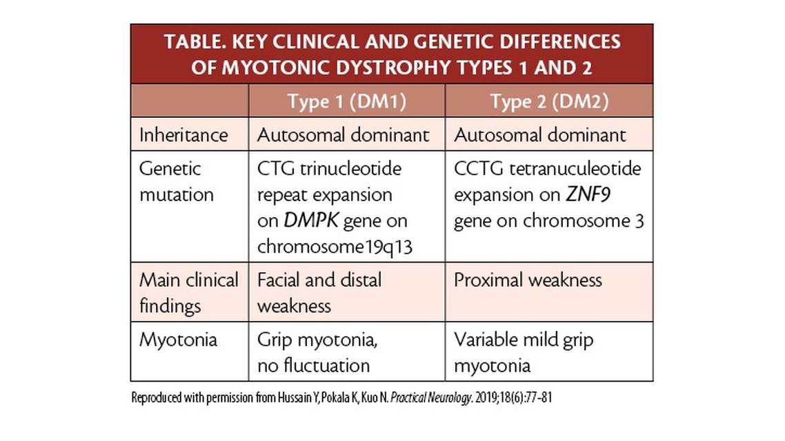 Noninflammatory Myopathies