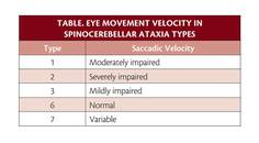 Movement Disorders Moment Neurodegenerative Spinocerebellar Ataxia