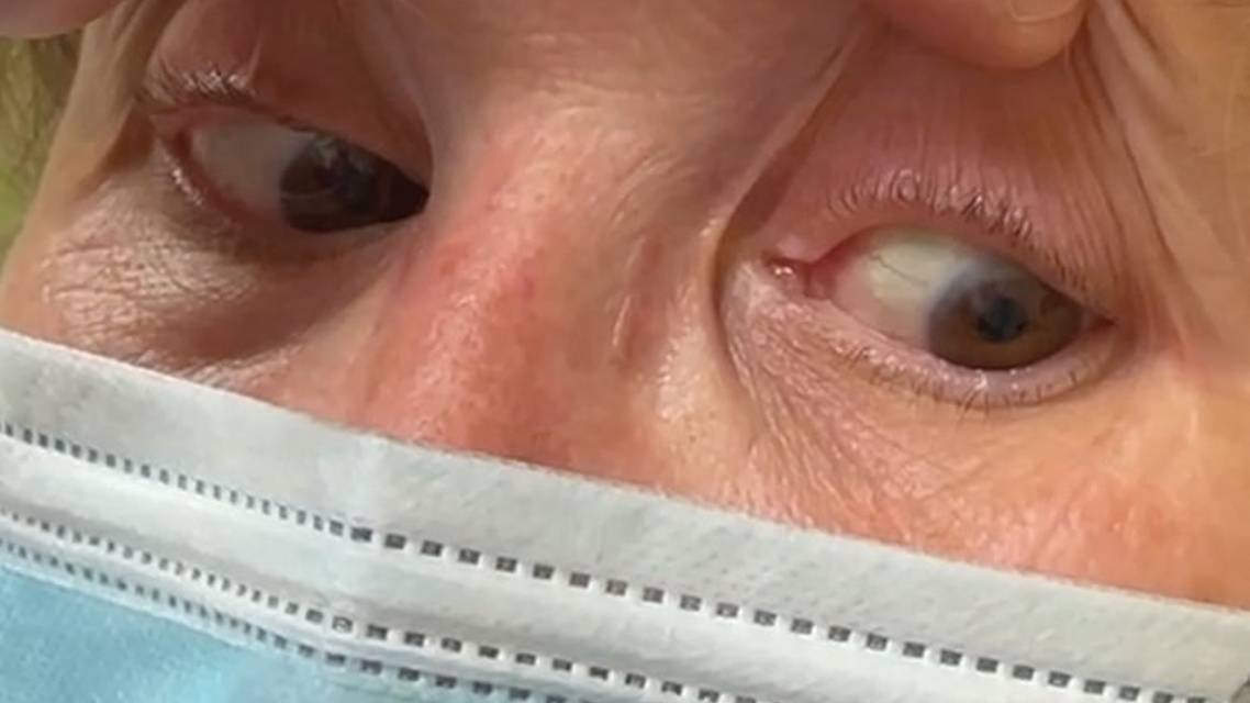 Case Conference Shaky Vision and Tired Left Eye