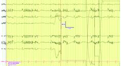 PN0925 EE Fig 2C