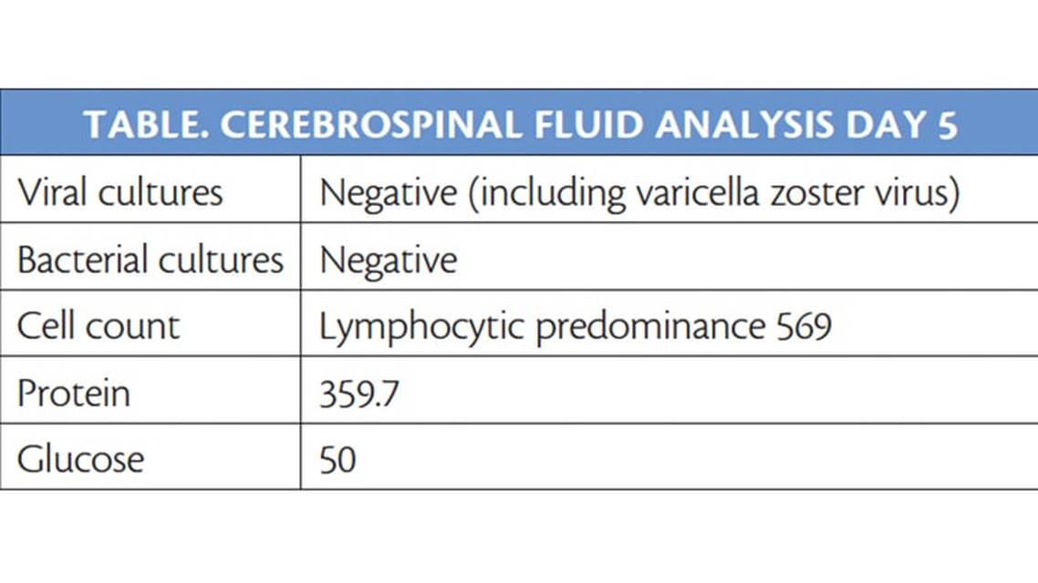 Challenge Case Report Aseptic Meningitis Worsening With Treatment