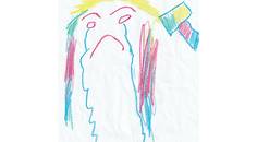 Migraine in Children and Adolescents