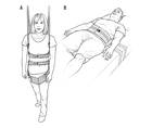 Epilepsy Essentials VideoEEG Monitoring
