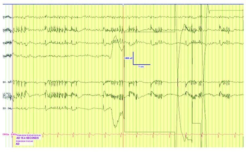 PN0925 EE Fig 2C