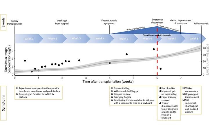 Severe Calcineurin Inhibitor Induced Parkinsonism After Kidney Transplantation