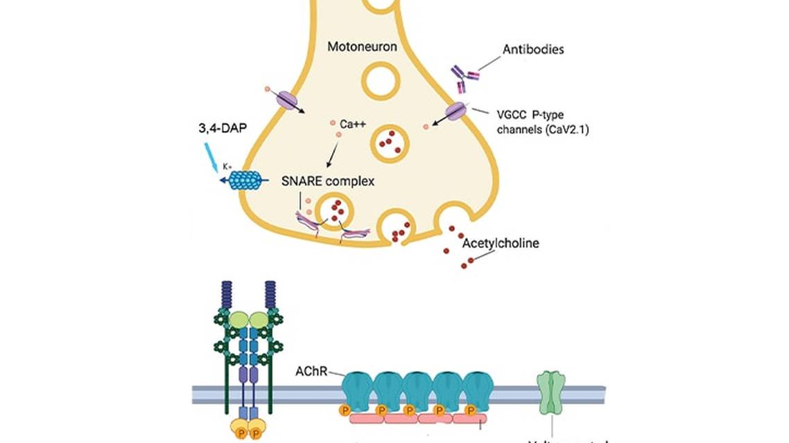 Diagnosis and Treatment of Lambert Eaton Myasthenic Syndrome