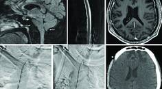 Panda et al case report Figure 1