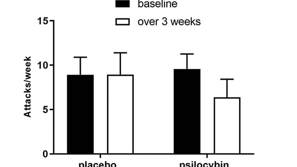 Headache Horizons The Study and Use of Psychedelics in Cluster Headache