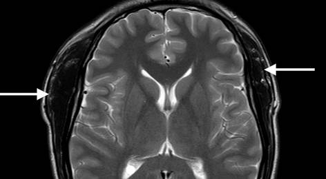 Special Report New Headache Findings - 2f388b66c84a716a30f01db62685f741 