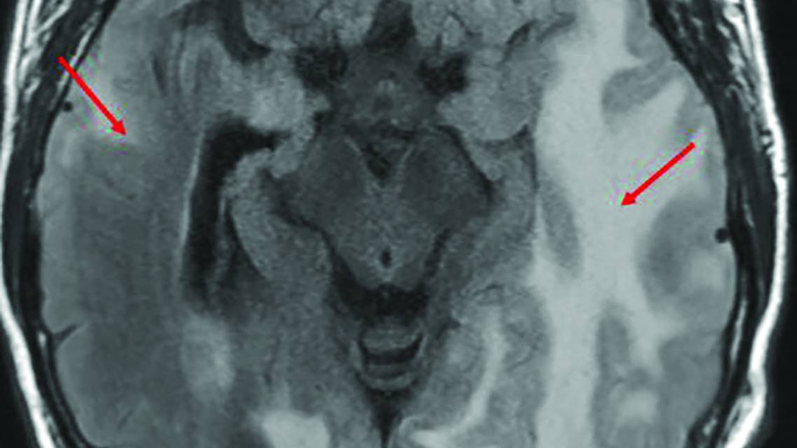 PN0725 Bouchachi Fig 1