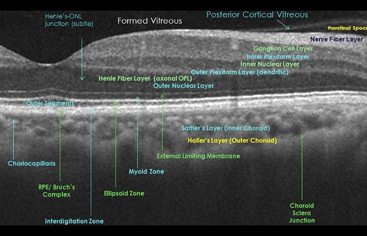 Optical Coherence Tomography and Neurology
