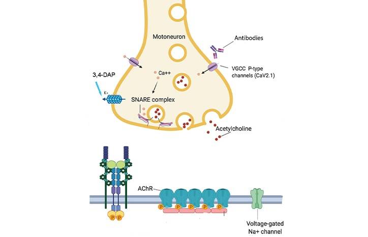 Diagnosis and Treatment of Lambert Eaton Myasthenic Syndrome