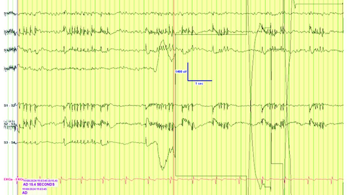 PN0925 EE Fig 2C