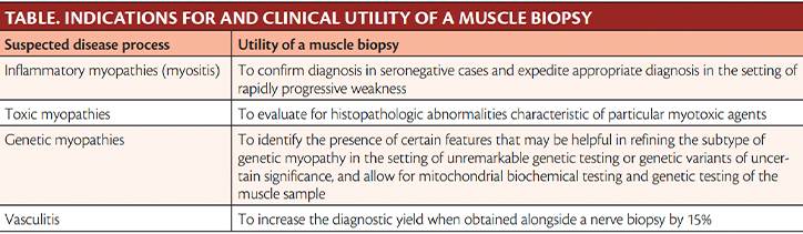 Neuromuscular Notes When to Order a Muscle Biopsy