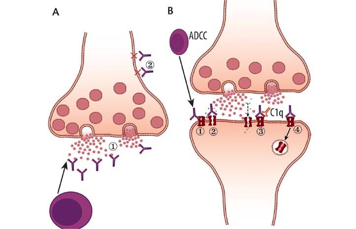 Autoimmune Movement Disorders in Children