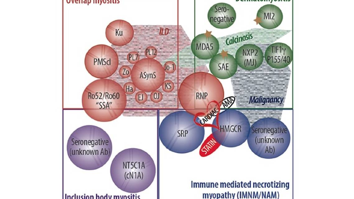 Inflammatory Myopathies