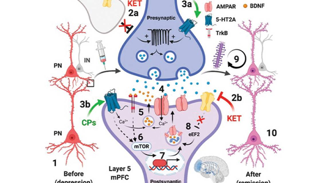 Headache Horizons Emerging Use of Ketamine for the Treatment of Migraine and Other Headache Disorders