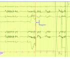 PN0925 EE Fig 2C