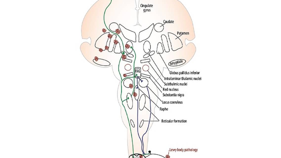 Movement Disorders Moment Pain and Palliative Care in Movement Disorders