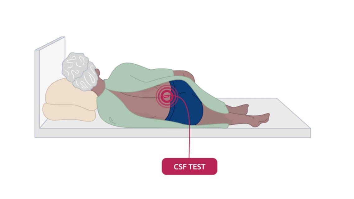 CSF Test Image