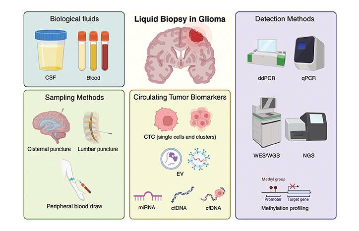 Circulating Biomarkers in Diffuse Gliomas Current Landscape and Future Directions