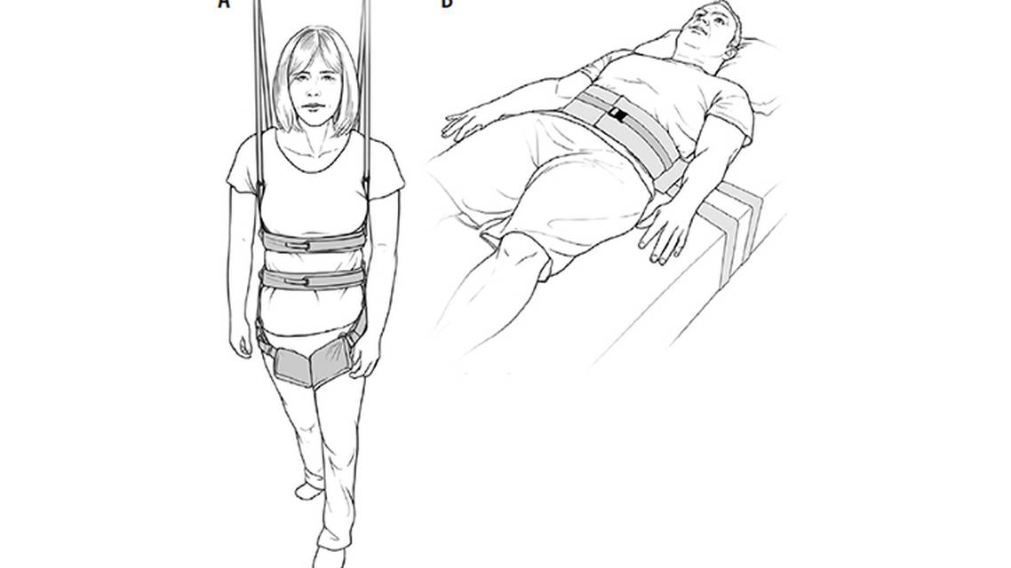 Epilepsy Essentials VideoEEG Monitoring