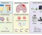 Circulating Biomarkers in Diffuse Gliomas Current Landscape and Future Directions
