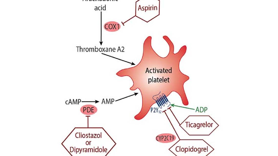 Antiplatelet Therapies After Ischemic Stroke