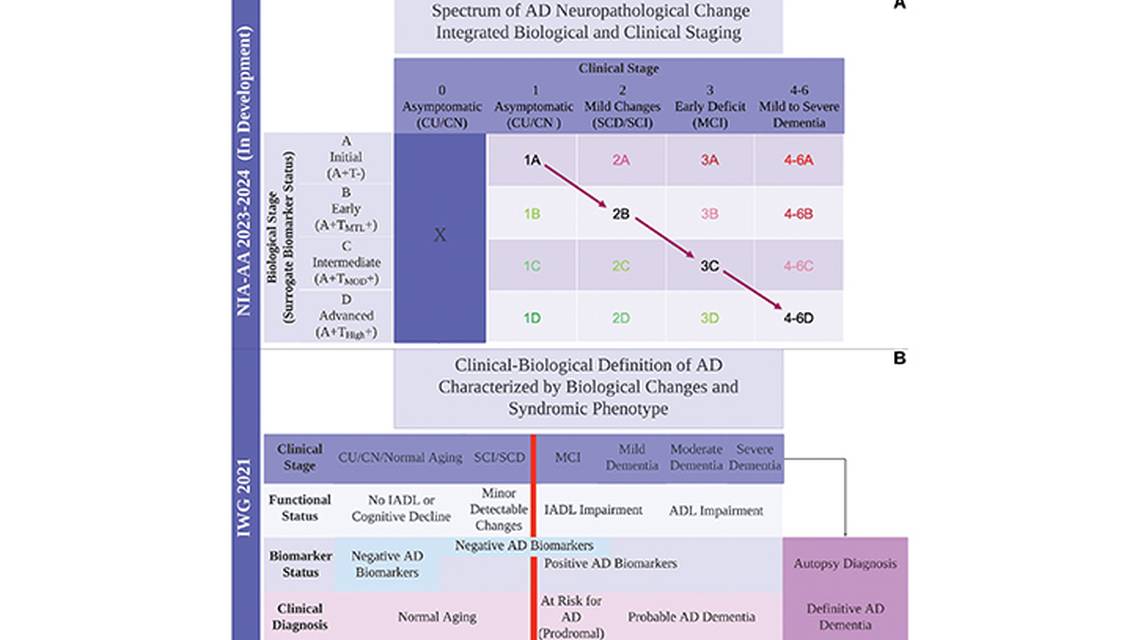 Blood Based Biomarkers in Alzheimer Disease Clinical Implementation and Limitations
