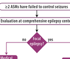 Epilepsy Essentials Neuromodulation for Drug Resistant Epilepsy