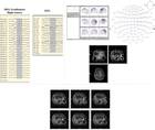 Epilepsy Essentials Application of Magnetoencephalography in the Diagnosis and Treatment of Epilepsy