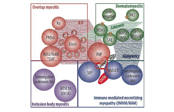 Inflammatory Myopathies