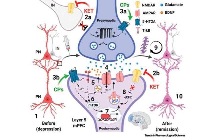 Headache Horizons Emerging Use of Ketamine for the Treatment of Migraine and Other Headache Disorders