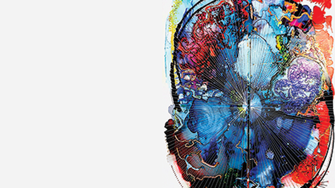 The Multiple Sclerosis Prodrome Past Present and Future