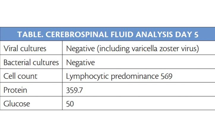 Challenge Case Report Aseptic Meningitis Worsening With Treatment