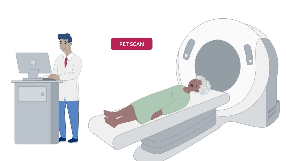 Schindler Episode 3 PET Test