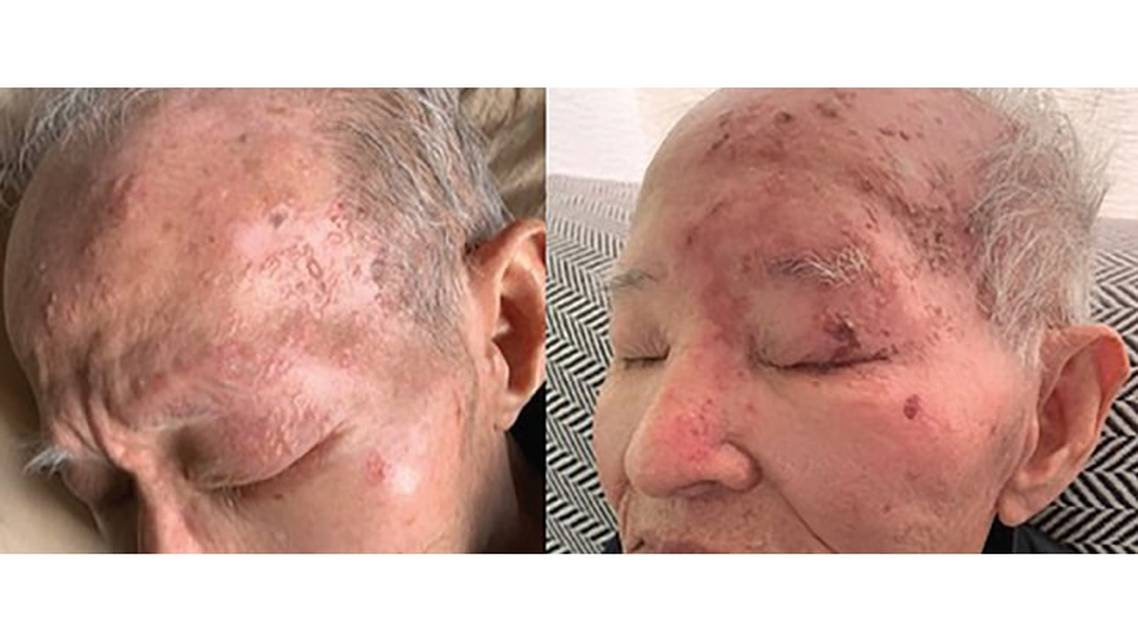 Neuro ophthalmology Options Secondary Causes of Eye Pain