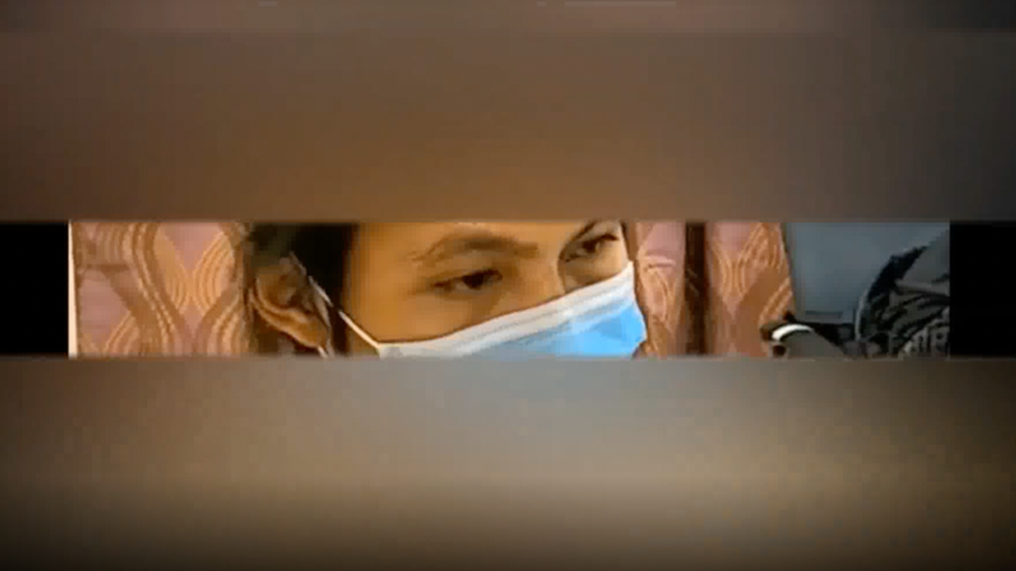 Ocular bobbing in eosiniphilic meningitis resolved thumbnail