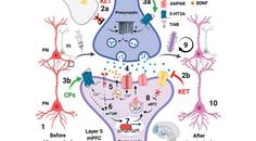 Headache Horizons Emerging Use of Ketamine for the Treatment of Migraine and Other Headache Disorders