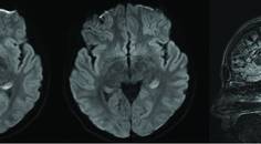 Maranto et al Figure 3