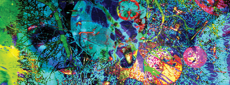 Surgical Management of Intractable Epilepsy